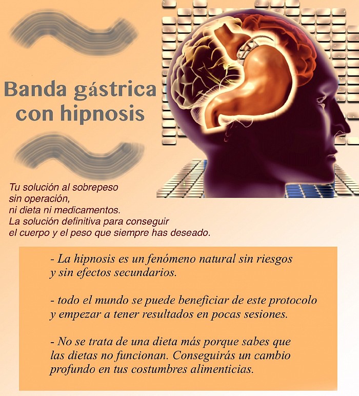 Banda gástrica con hipnosis 